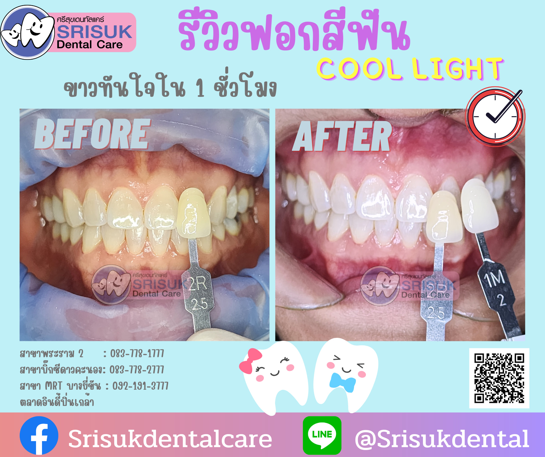 Before & After 1