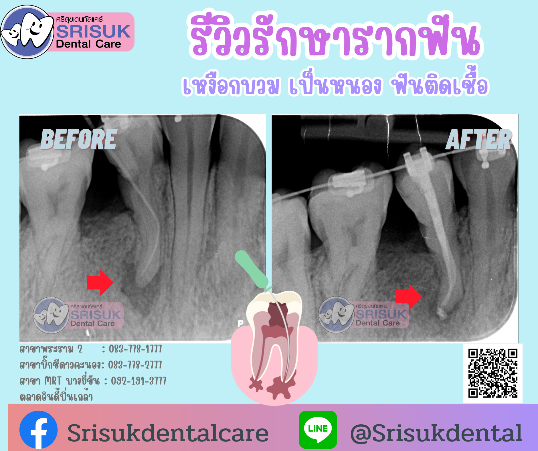 Before & After 3